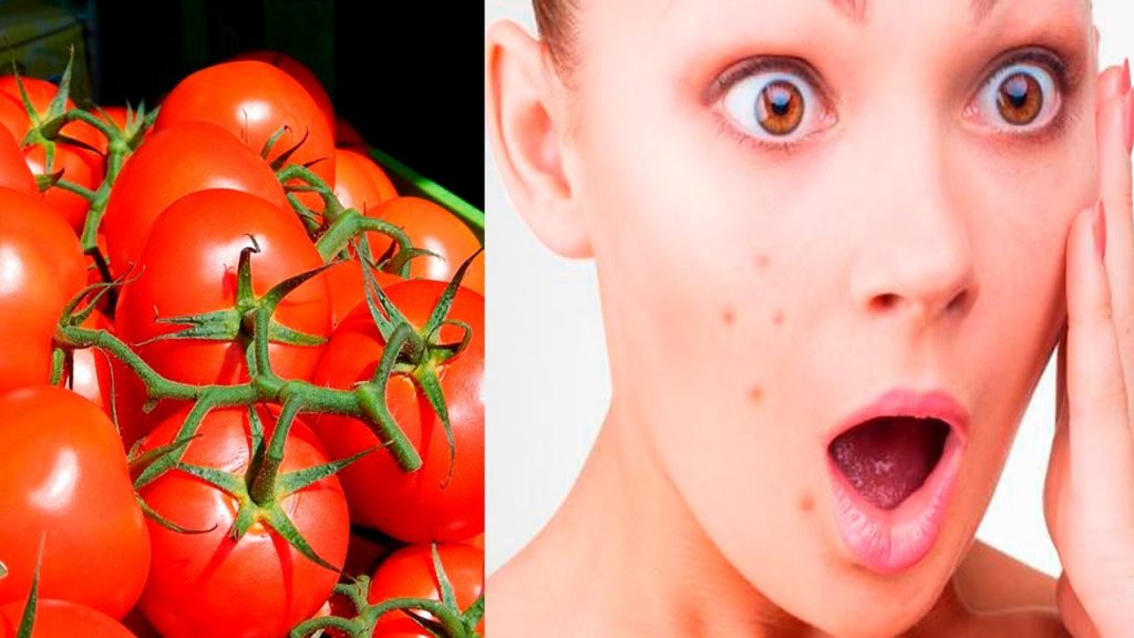 mascarilla de tomate para el acne